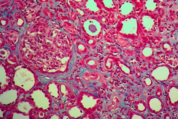 Image of Human Kidney Tissue